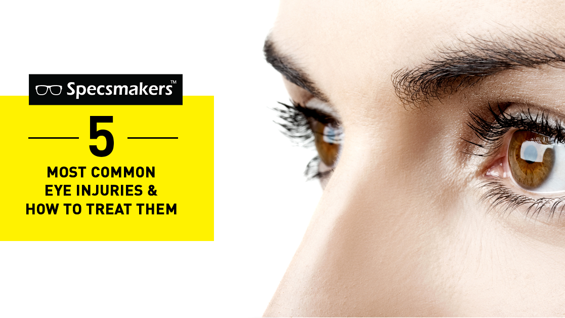 5 Most Common Eye Injuries and How to Treat Them