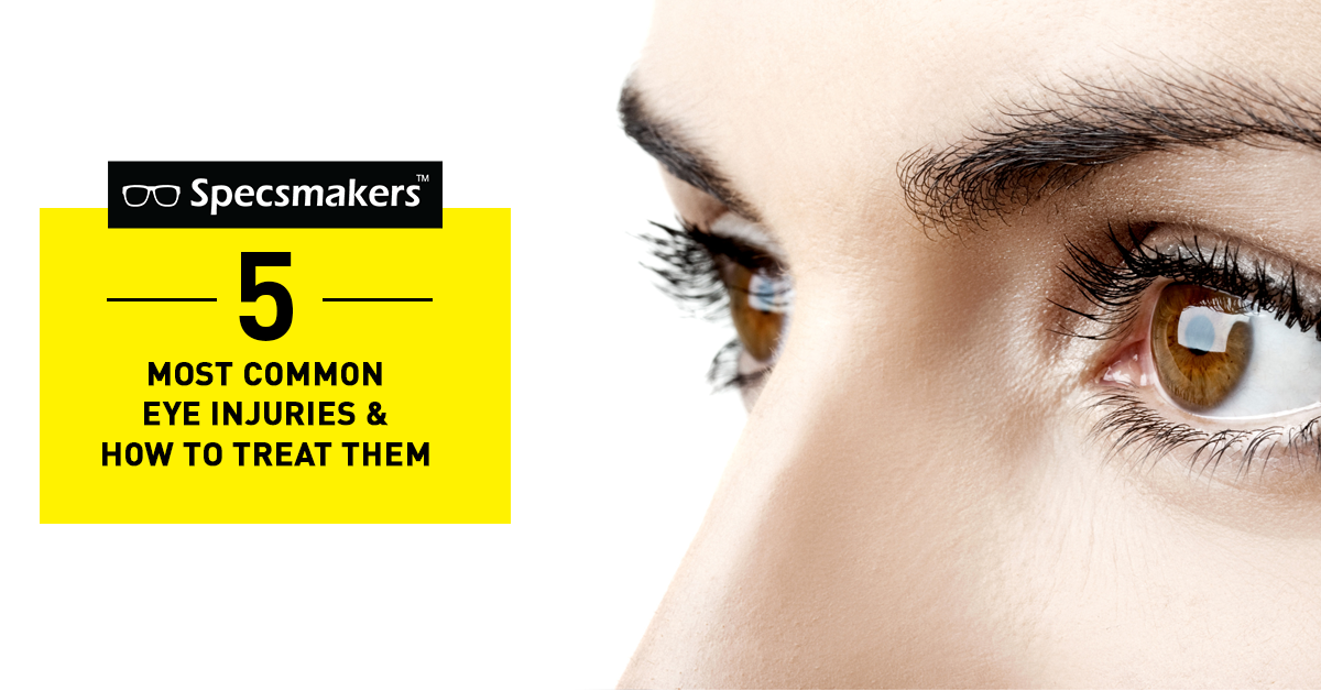 5 Most Common Eye Injuries and How to Treat Them - Specsmakers | Frame ...