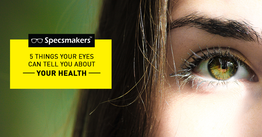5 things your eyes can tell you about your health